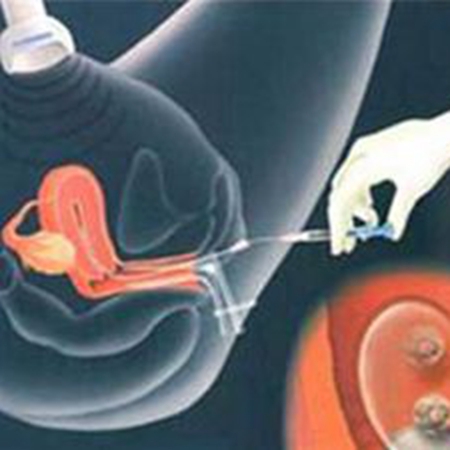 How does the fertilized egg move from the fallopian tube to the uterus?