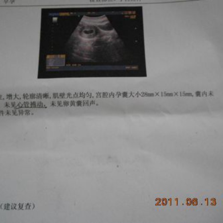 Experts teach you how to do B-ultrasound examination during pregnancy