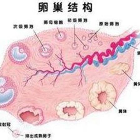 A comprehensive talk about polycystic ovary syndrome