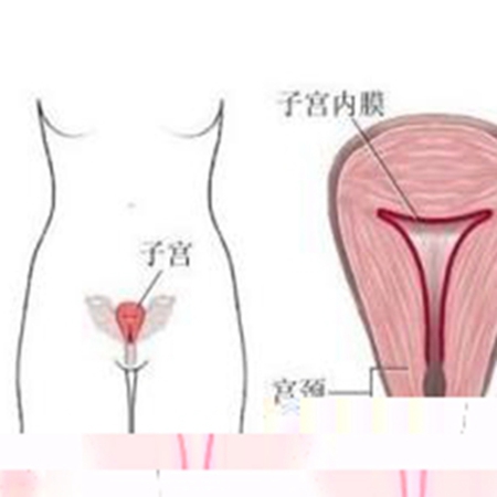 Who knows whether the uterus is warm or cold? Do you know about endometriosis?