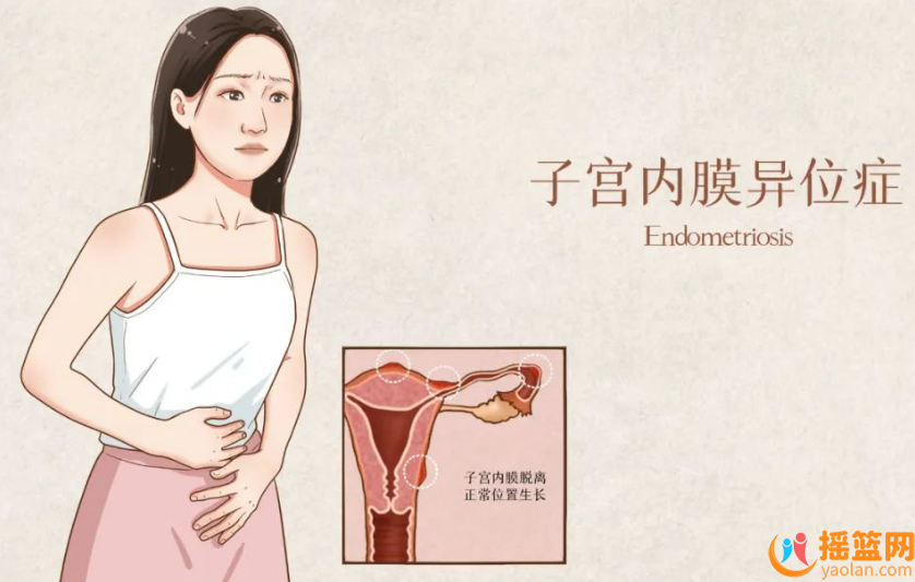 40% infertility rate? Endometriosis Western Medicine, Traditional Chinese Medicine Solutions