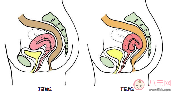 How to get pregnant with posterior uterus position, uterine guard conception position