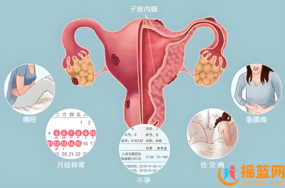 A comprehensive introduction to endometriosis