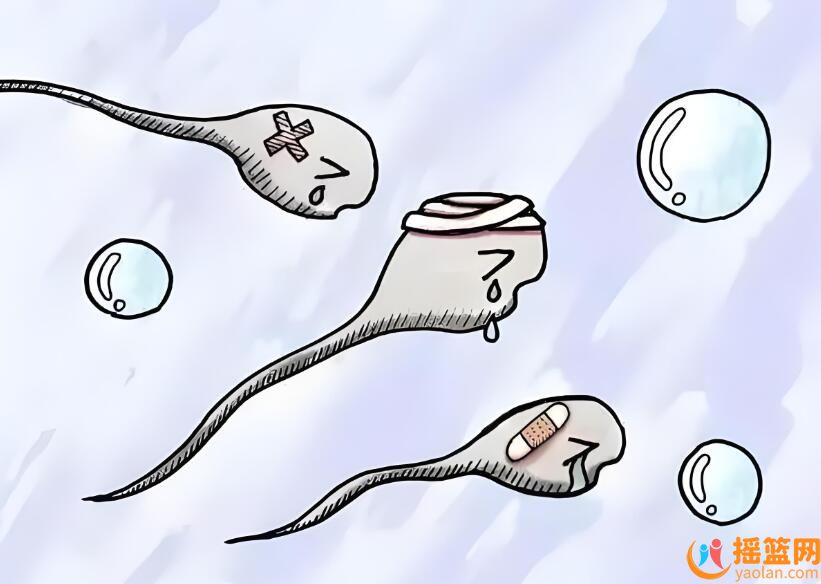 What are the typical characteristics of male weak sperm? Did you know?