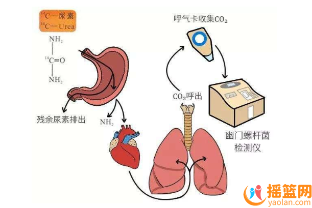 Does Helicobacter pylori affect pregnancy preparation? What are the inspection methods?